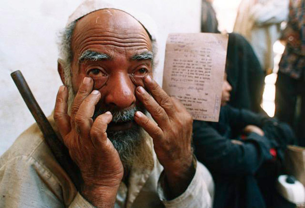 Man physically blinded by the 1984 Dow Chemical (Union Carbide) disaster.